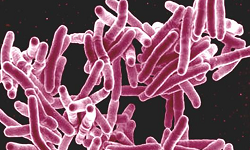 Mycobacterium tuberculosis complex